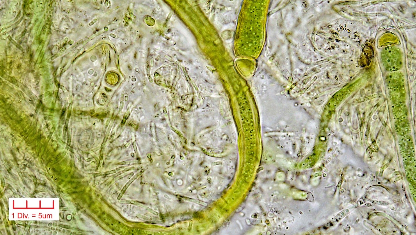 ./Cyanobacteria/Nostocales/Rivulariaceae/Calothrix/parietina/440.jpg