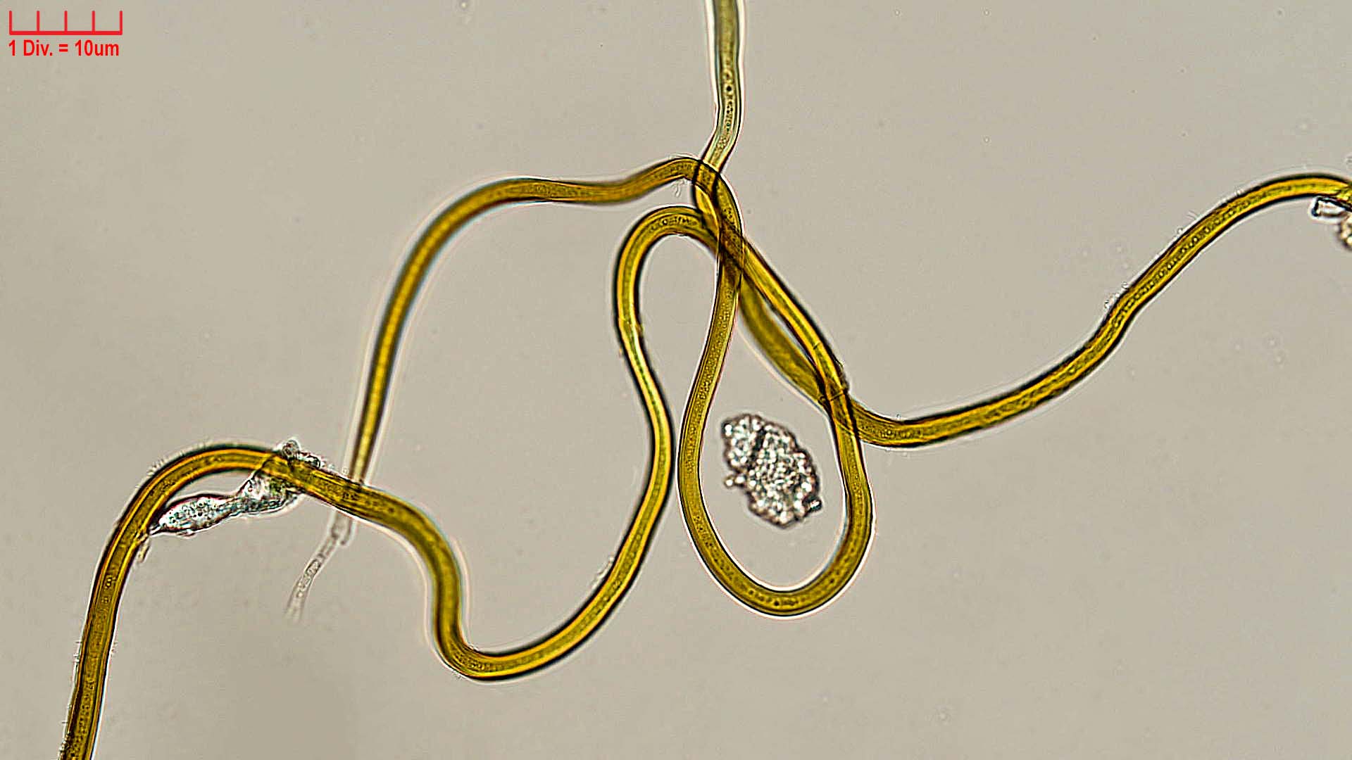 ./Cyanobacteria/Nostocales/Scytonemataceae/Scytonematopsis/starmachii